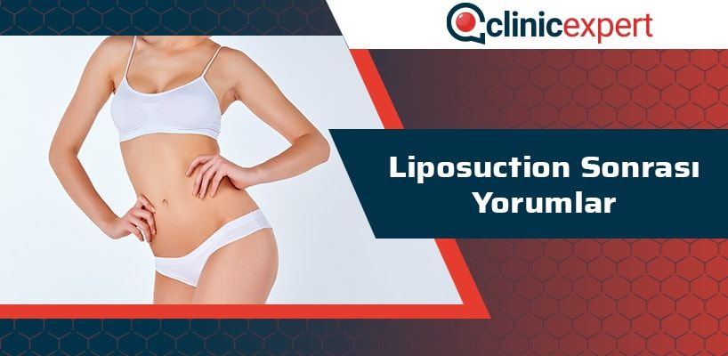 liposuction-sonrasi-yorumlar-cln-min