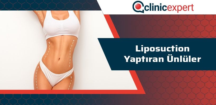 liposuction-yaptiran-unluler-cln-min