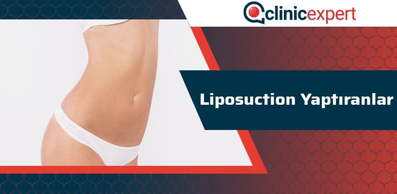 liposuction-yaptiranlar-cln-min