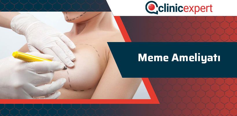meme-ameliyati-cln