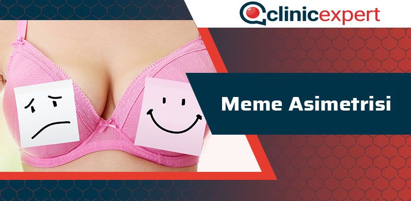 meme-asimetrisi-cln