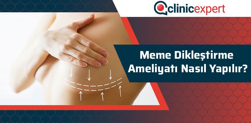 meme-diklestirme-ameliyati-nasil-yapilir-cln