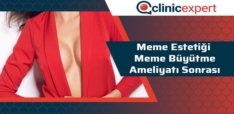 meme-estetigi-meme-buyutme-ameliyati-sonrasi-cln