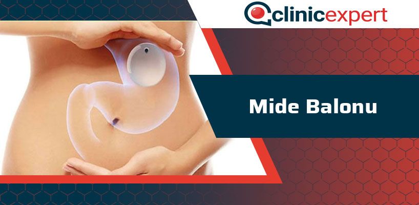 mide-balonu-cln