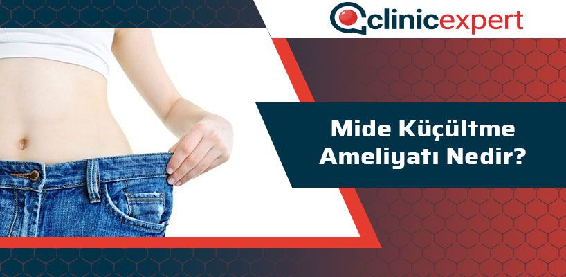mide-kucultme-ameliyati-nedir-cln