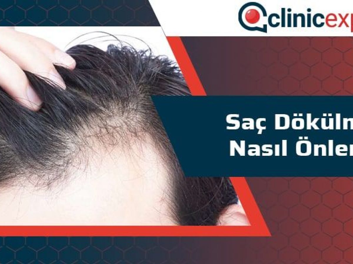 Sac Dokulmesi Nasil Onlenir Clinicexpert Uluslararasi Saglik Hizmetleri