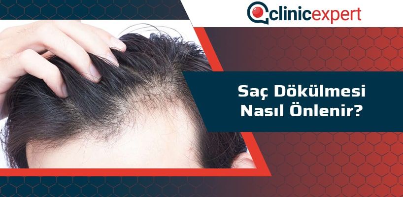 Sac Dokulmesi Nasil Onlenir Clinicexpert Uluslararasi Saglik Hizmetleri