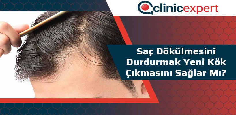 Saç Dökülmesini Durdurmak Yeni Kök Çıkmasını Sağlar mı?