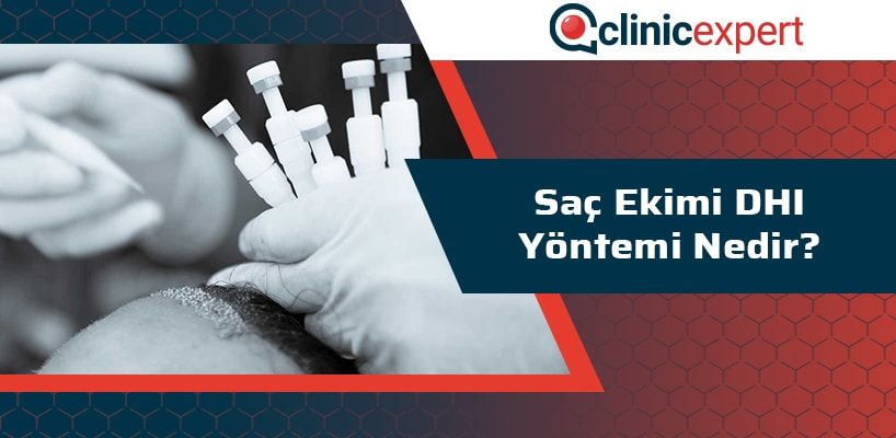 sac-ekimi-dhi-yontemi-nedir-cln-min