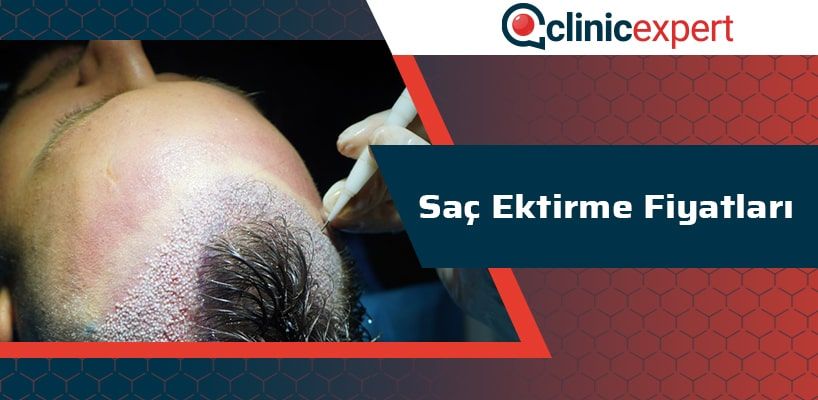 Saç Ektirme Fiyatları