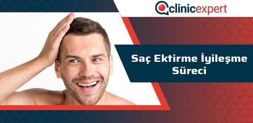 Saç Ektirme İyileşme Süreci