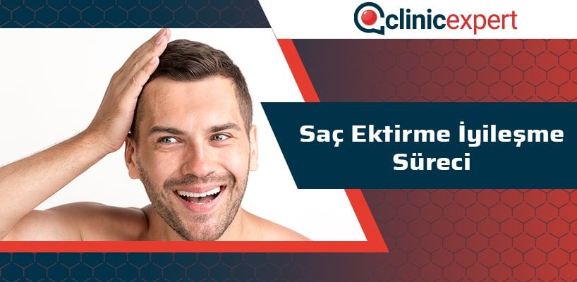 Saç Ektirme İyileşme Süreci