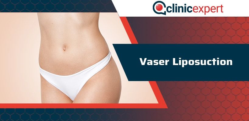 vaser-liposuction-cln-min