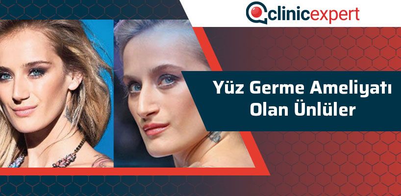 Yüz Germe Ameliyatı Olan Ünlüler