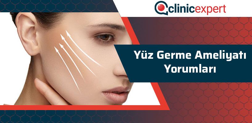 Yüz Germe Ameliyatı Yorumları