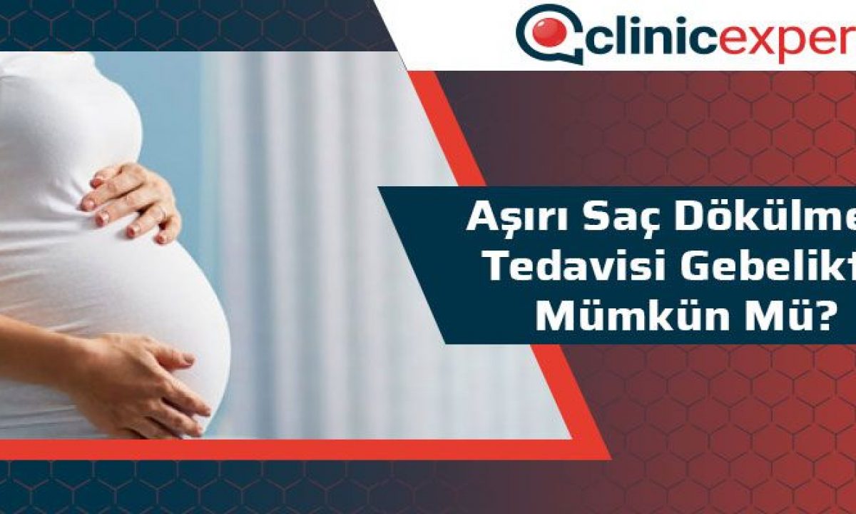 Asiri Sac Dokulmesi Tedavisi Gebelikte Mumkun Mu