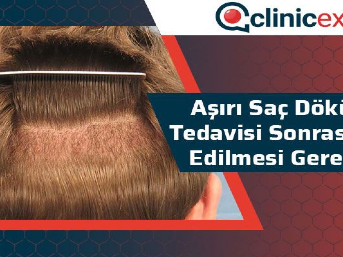 Asiri Sac Dokulmesi Tedavisi Sonrasi Dikkat Edilmesi Gerekenler