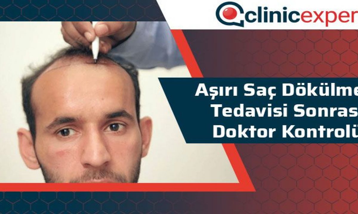 Asiri Sac Dokulmesi Tedavisi Sonrasi Doktor Kontrolu Asiri Sac Dokulmesi Tedavisi Sonrasi Doktor Kontrolu