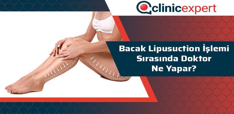 Bacak Liposuction İşlemi Sırasında Doktor Ne Yapar?