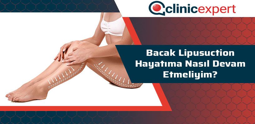 bacak-lipusuction-sonrasi-hayatima-nasil-devam-etmeliyim-cln