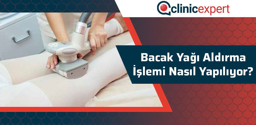 bacak-yagi-aldirma-islemi-nasil-yapiliyor-cln