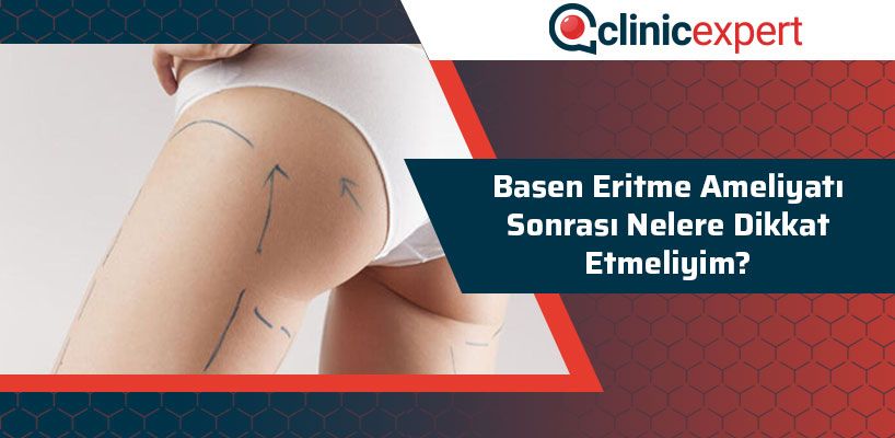 Basen Eritme Ameliyatı Sonrası Nelere Dikkat Etmeliyim?