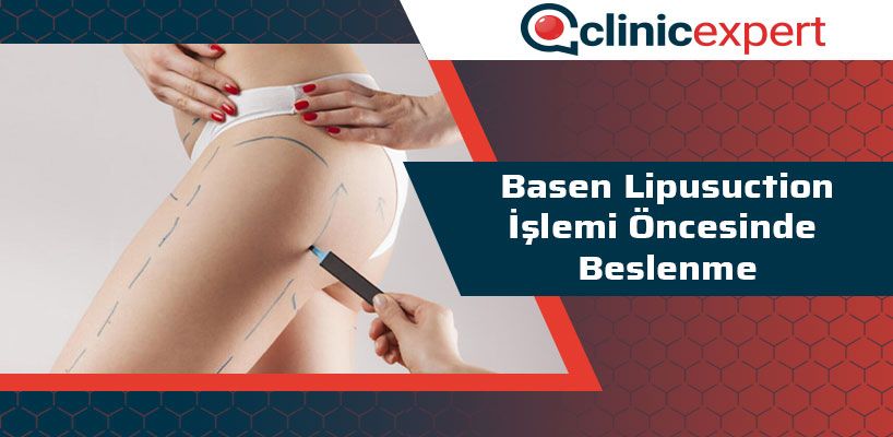 basen-lipusuction-islemi-oncesinde-beslenme-cln