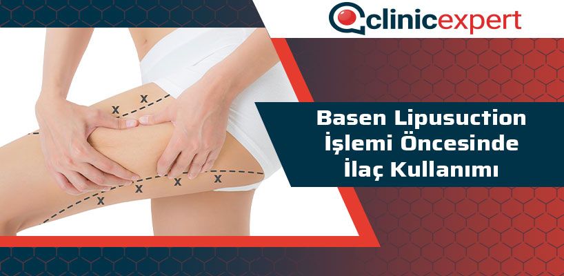 basen-lipusuction-islemi-oncesinde-ilac-kullanimi-cln