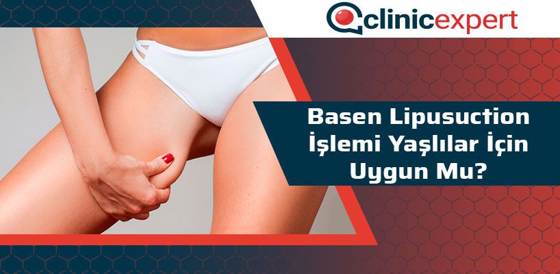 basen-lipusuction-islemi-yaslilar-icin-uygun-mu-cln