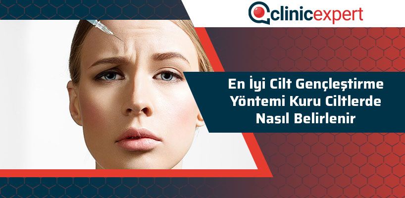 En İyi Cilt Gençleştirme Yöntemi Kuru Ciltlerde Nasıl Belirlenir?