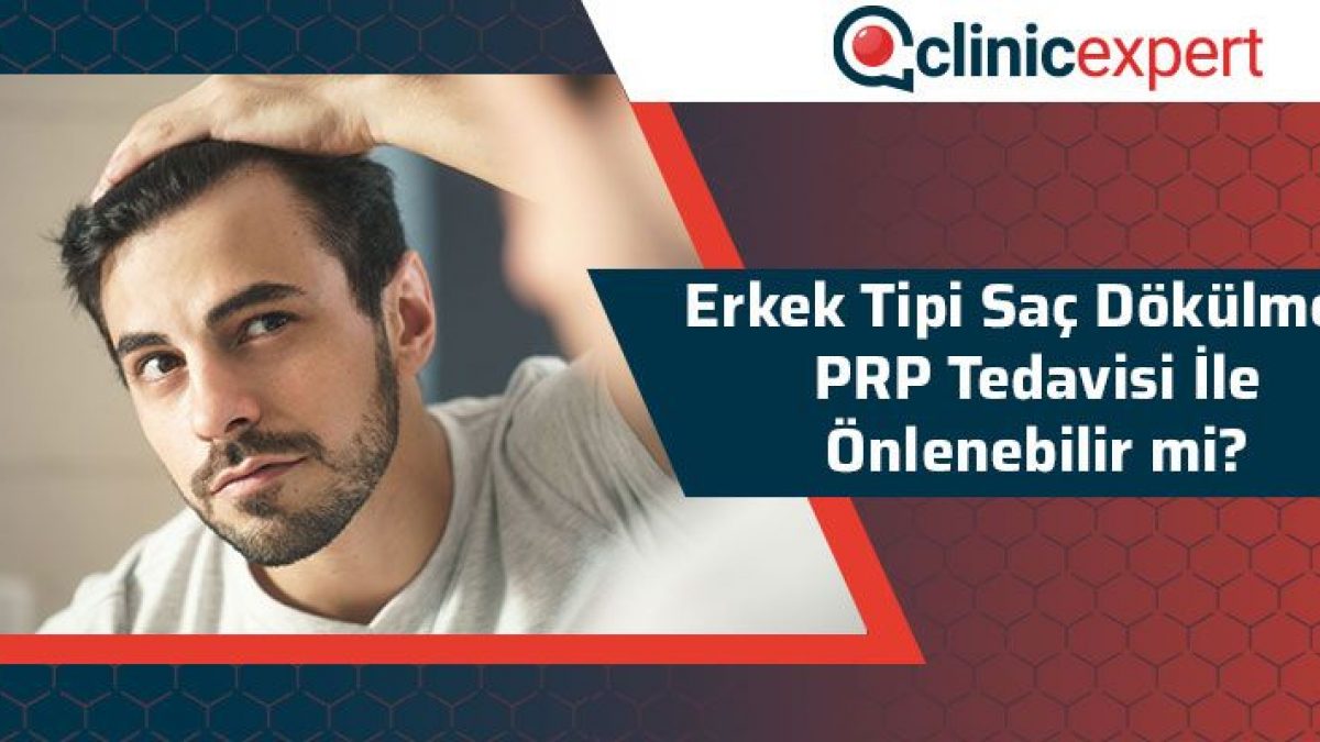 Erkek Tipi Sac Dokulmesi Prp Tedavisi Ile Onlenebilir Mi