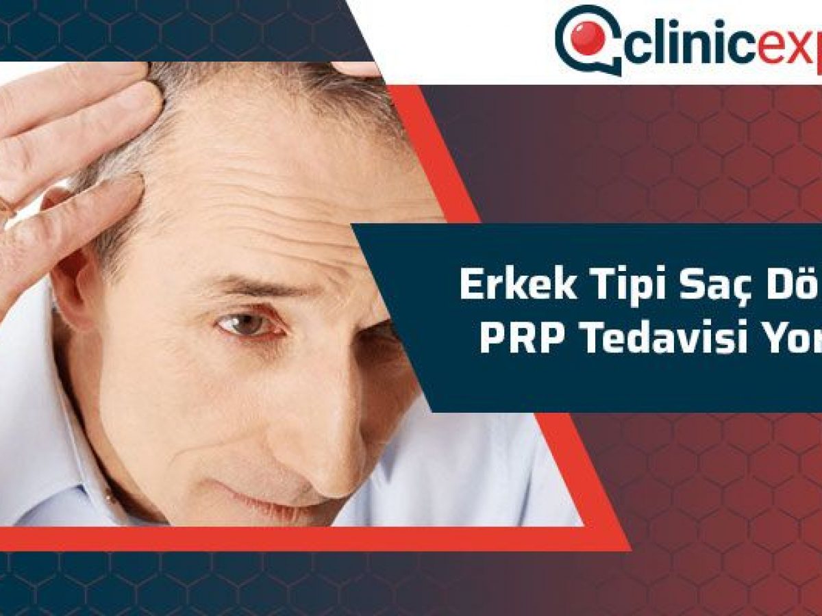 Erkek Tipi Sac Dokulmesi Ve Prp Tedavisi Yorumlari Clinicexpert Com Erkek Tipi Sac Dokulmesi Ve Prp Tedavisi Yorumlari Clinicexpert Com