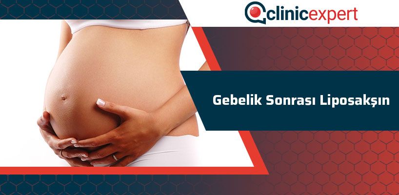 gebelik-sonrasi-liposaksin-cln