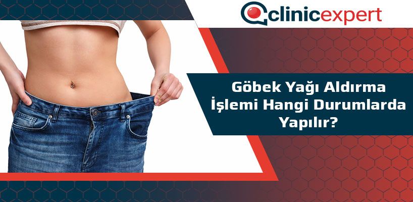 Göbek Yağı Aldırma İşlemi Hangi Durumlarda Yapılır