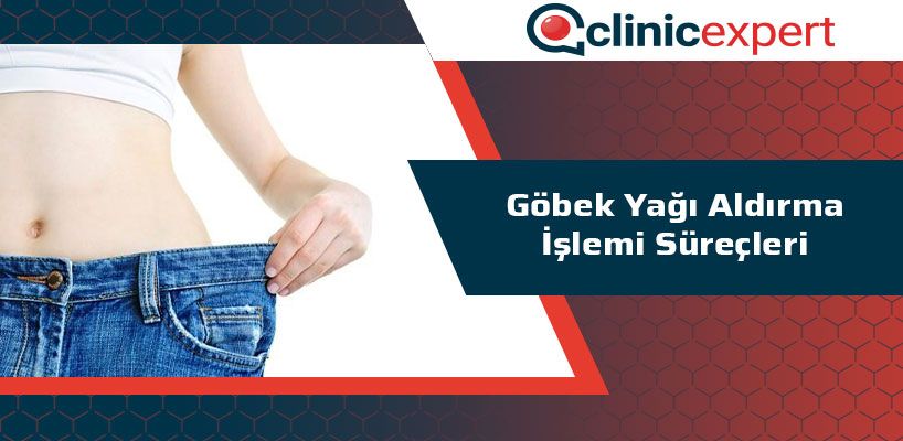 gobek-yagi-aldirma-islemi-surecleri-cln