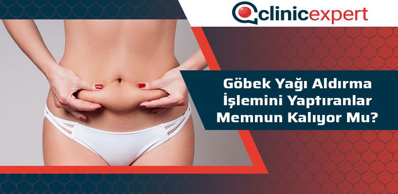 gobek-yagi-aldirma-islemini-yaptiranlar-memnun-kaliyor-mu-cln