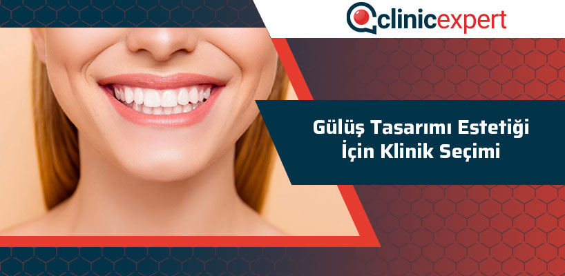 Gülüş Tasarımı Estetiği İçin Klinik Seçimi