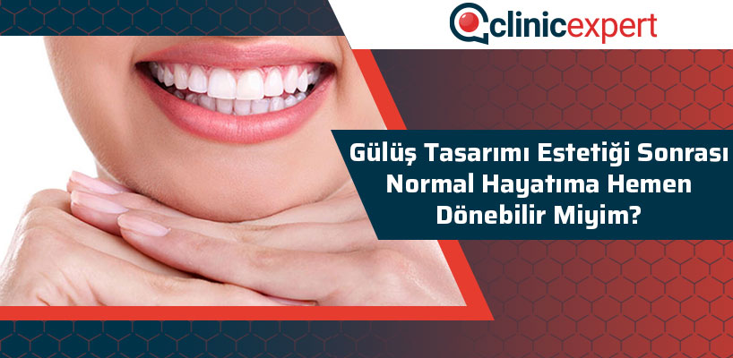 Gülüş Tasarımı Estetiği Sonrası Normal Hayatıma Hemen Dönebilir Miyim?