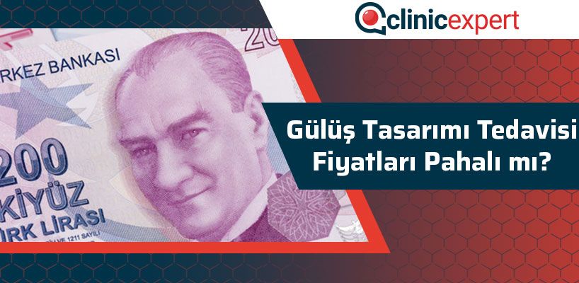 Gülüş Tasarımı Tedavisi Fiyatları Pahalı Mı?