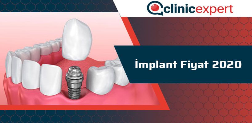implant-fiyat-2020-cln