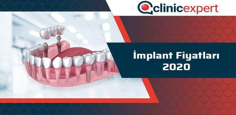 implant-fiyatlari-2020-cln