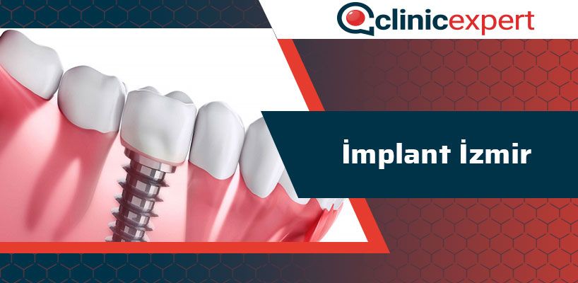 implant-izmir-cln
