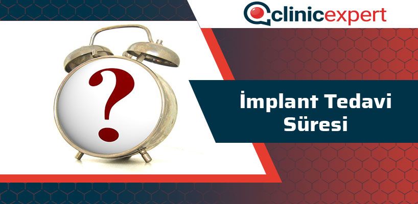 implant-tedavi-suresi-cln