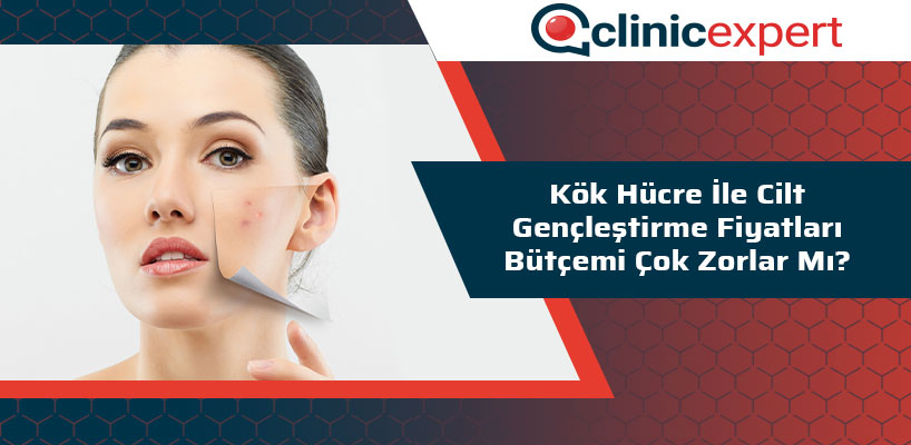 Kök Hücre ile Cilt Gençleştirme Fiyatları Bütçemi Çok Zorlar Mı?