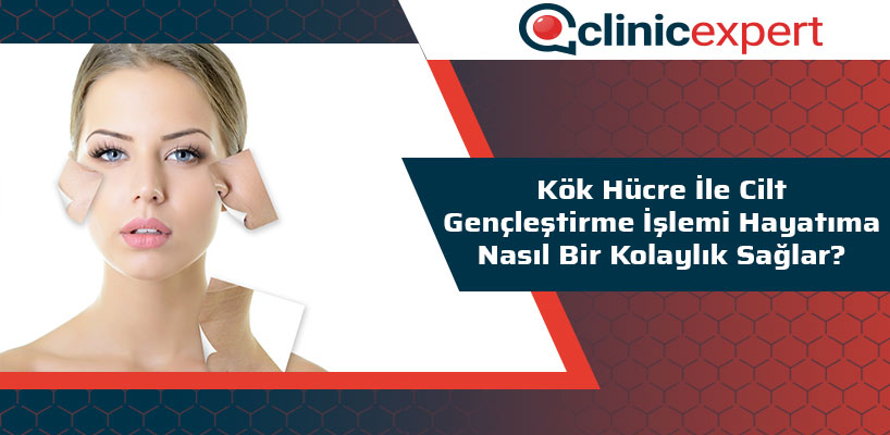 Kök Hücre ile Cilt Gençleştirme İşlemi Hayatıma Nasıl Bir Kolaylık Sağlar?