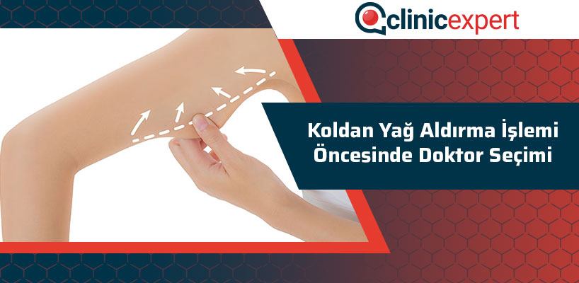 Koldan Yağ Aldırma İşlemi Öncesinde Doktor Seçimi