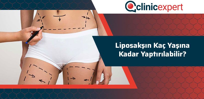 liposaksin-kac-yasina-kadar-yaptirilabilir-cln