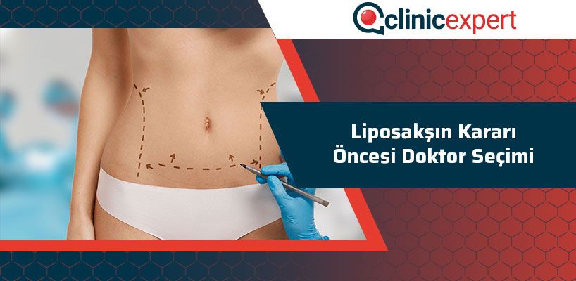 Liposakşın Kararı Öncesi Doktor Seçimi