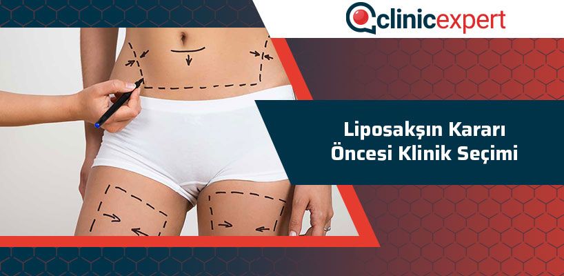 Liposakşın Kararı Öncesi Klinik Seçimi