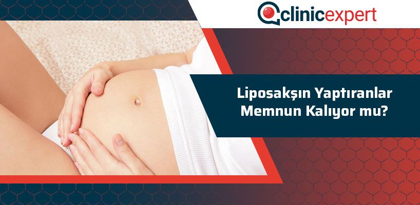 liposaksin-yaptiranlar-memnun-kaliyor-mu-cln